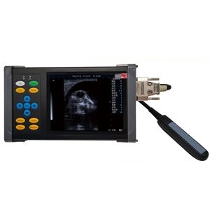 MT-A20 médical HOCHEY Scanner ultrasonique <span class=keywords><strong>sans</strong></span> <span class=keywords><strong>fil</strong></span> vétérinaire de poche, haute définition, excellente imagerie - Product Image 1
