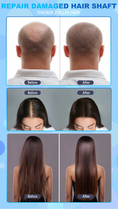 New Arrivals Multifunctional 15 Inch 5 in 1 High Frequency Hair Scalp Massage Device for Hair Spa - Product Image 4