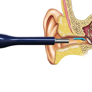 카메라와 가벼운 귀 왁스 제거 키트가있는 맞춤형 귀 카메라 도구 귀 클리너