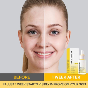 Marque privée Soin du visage Offre Spéciale de beauté Sérum éclaircissant raffermissant pour le visage Sérum à la vitamine E Acide hyaluronique Sérum à la vitamine C pour le visage - Product Image 3
