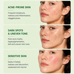 Sérum apaisant Greenlem Tea Tree, apaise les peaux sensibles, cible l'acné et les imperfections, formule Tea Tree, 30 ml - Product Image 2