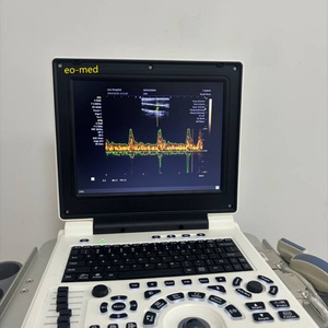 เครื่องอัลตราซาวนด์แบบพกพาคุณภาพสูง ดิจิทัลเต็มรูปแบบ รุ่น BW20 สำหรับการตรวจวินิจฉัยทางการแพทย์ - Product Image 3