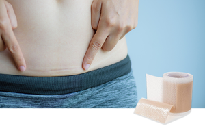 Lembar bekas luka silikon untuk bekas luka bedah, pita bekas luka silikon kelas medis untuk perawatan Keloid perut bagian C - Product Image 4