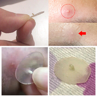 Prix usine huile d'arbre à thé acné patchs plâtre hydrocolloïde bouton maître Invisible enlever Patch pour les soins de la peau