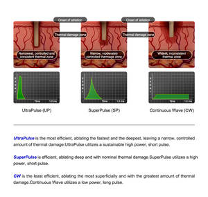 Fractional CO2 Vaginal Laser Haut Narben entferner Beauty Equipment mit Fraccionado CO2 Laser für die Haut - Product Image 5