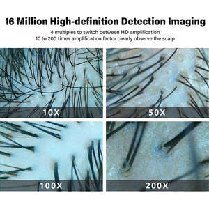 HD顕微鏡AIヘアアナライザー3Dデスクトップ頭皮スキャナー肌検出器 家庭用頭皮・顔分析機 - Product Image 3