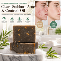 Savon noir africain artisanal marocain, naturel, biologique, anti-acné, éclaircissant, exfoliant, blanchissant, marque privée