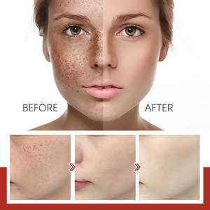 Crème pour les ongles pour une hydratation quotidienne, pour estomper les taches de rousseur et les taches brunes, pour le soin de la peau et la beauté. 30 grammes. - Product Image 5