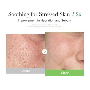Mascarilla de barro nocturna con camelia, té verde y aloe vera - <span class=keywords><strong>Tratamiento</strong></span> antiacné y antialérgico para todo tipo de <span class=keywords><strong>piel</strong></span> - Product Image 6