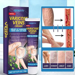 OEM Wholesale Vherbal Plant Extract <strong>Varicose</strong> <strong>Veins</strong> <strong>Treatment</strong> Best <strong>Cream</strong> Ointment <strong>Cream</strong> <strong>Varicose</strong> <strong>Veins</strong> <strong>Cream</strong> - Product Image 5