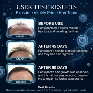 Tónico Capilar con Exosomas de Alta Actividad Derivados de Fuentes Bio-Naturales para Nutrir el Cuero Cabelludo, Recuperar el Cabello y un Cuidado Profesional - Product Image 6