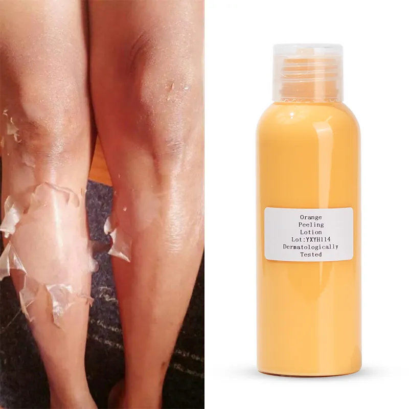 Private Label Body Care Verwijderen Dode Huid Lichter Smoothing Whitening Exfoliërende Crème Organische Oranje Peeling Lotion