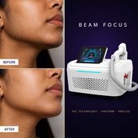 Machine de beauté multifonctionnelle pour l'épilation, machine à diode pour l'épilation, machine à diode laser à 4 longueurs d'onde pour l'épilation, Tga Hairspa