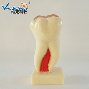 6 kali Model profil anatomis dari Molar Mandibular yang geraham Mandibular di dekat