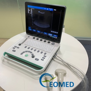 Ecógrafo Doppler Color Portátil al Mejor <span class=keywords><strong>Precio</strong></span>, con PDI, Dispositivo de Ultrasonido General para Diagnóstico Hospitalario, Ecografía CU09 - Product Image 1