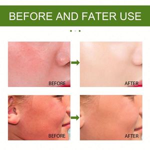 Hoygi Großhandel Private Label 60ML Tiefenreinigendes Feuchtigkeitsspendendes Revitalisierendes Gesichts-Aloe-<span class=keywords><strong>Vera</strong></span>-Peeling-Gel Akne-Behandlung - Product Image 6