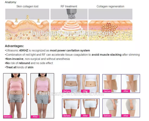 Appareil de soin du visage et du corps 6-en-1 CAVI RF amincissant, blanchissant, avec ventouses sous vide, pour salon de beauté et spa professionnel - Product Image 6