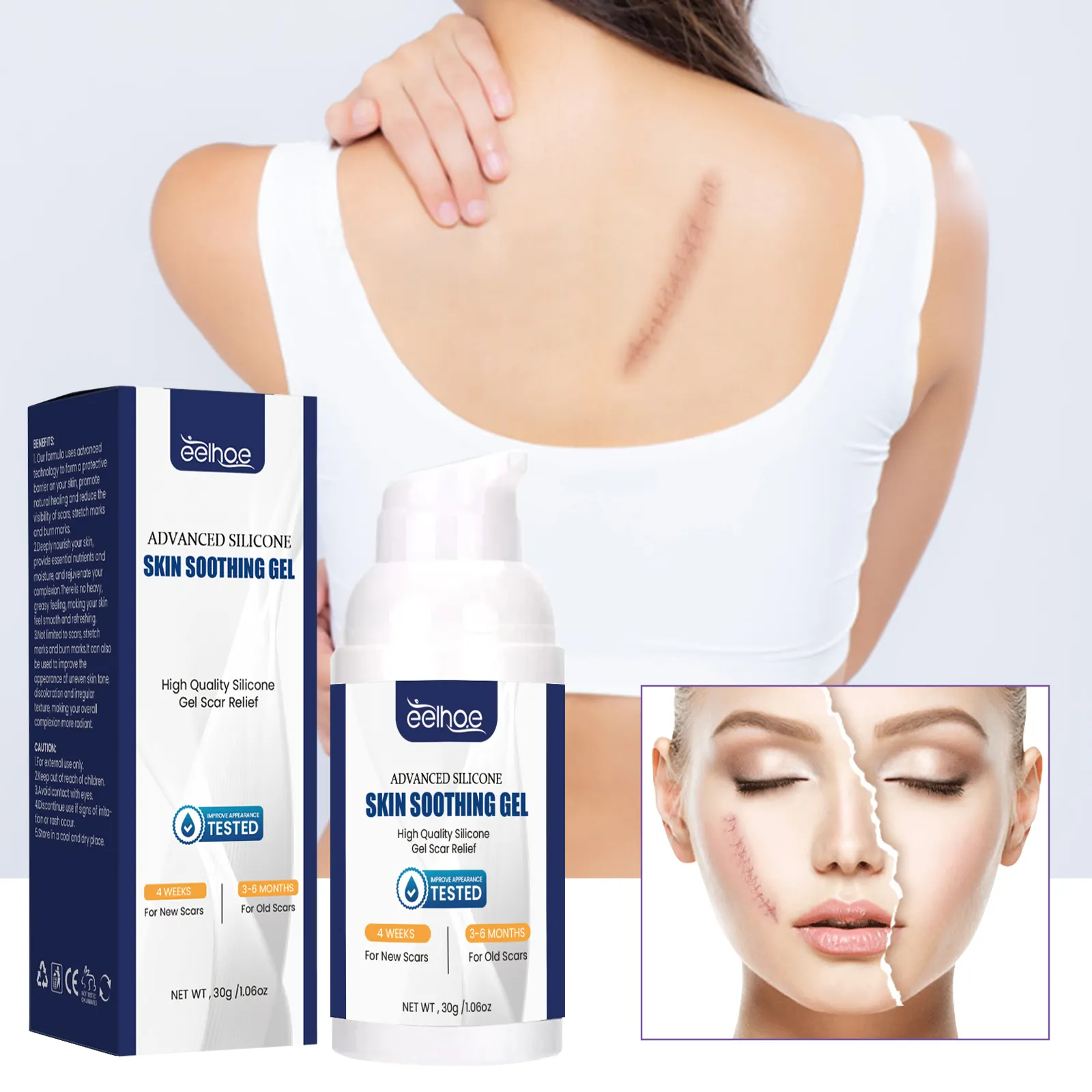 Eelhoe Private Label Effective Scar Removal Cream For Old Scar Mark Removal Cream Stretch Marks Repair Acne Treatment