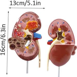 Modè<span class=keywords><strong>le</strong></span> de rein en sciences médicales, pathologie, double perspective avec rein <span class=keywords><strong>normal</strong></span> <span class=keywords><strong>et</strong></span> malade pour l'enseignement de l'anatomie <span class=keywords><strong>et</strong></span> de la physiologie humaine - Product Image 2