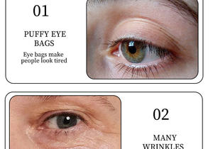 มาส์กใต้ตา Private Label ขายส่ง OEM ODMDamascus Rose Starry Sky ผสมไฮยาลูรอนิค แอซิด วิตามินอี ลดรอยคล้ำใต้ตาและอาการบวม - Product Image 4