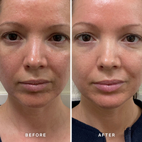 Sérum éclaircissant naturel pour le visage, produit de marque privée, sérum de Niacinamide blanchissant pour la peau du visage