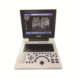 Système de diagnostic par ultrasons pour ordinateur portable S30B, écran LCD HD 12 pouces, double transducteur, scanner vétérinaire entièrement numérique - Product Image 2