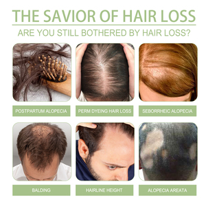 Huile Capillaire Naturelle Hydratante, Traitement Anti-Chute Soin du Cuir Chevelu, Huile Essentielle Végétale Bio pour la Croissance des Cheveux - Product Image 4