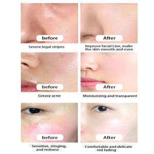 Crema de arroz orgánica de 50g personalizada 2025 con ingredientes de ácido hialurónico, gran oferta, crema hidratante suavizante reparadora de colágeno - Product Image 4