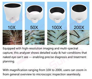เครื่องวิเคราะห์รูขุมขนและหนังศีรษะด้วย AI ปี 2026 ภาพคมชัดระดับ Ultra-HD 16MP พร้อมซูม 10X-200X สำหรับใช้ในร้านเสริมสวยและทางการแพทย์ - Product Image 5