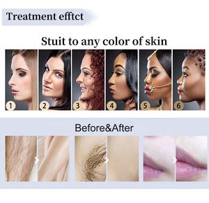 पेशेवर 808nm डायोड लेजर बालों को हटाने मशीन एक/डबल हैंडल के लिए बर्फ शीतलन - Product Image 3