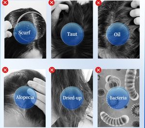 Hot 5 en 1 appareil de Diagnostic de la peau croissance des cheveux cuir chevelu Massage thérapie Machine follicule pileux Scanner dispositif analyseur de peau de cheveux - Product Image 4