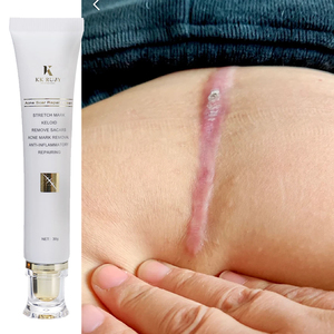 ครีมซ่อมแซมผิวสมุนไพรออร์แกนิคธรรมชาติ แบรนด์ OEM สำหรับรอยแตกลายจากการตั้งครรภ์ รอยสิว รอยแผลเป็นจากสิว - Product Image 6