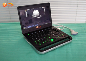 SUN-902B y tế siêu âm DOPPLER màu siêu âm cụ siêu âm DOPPLER màu siêu âm Vet sử dụng - Product Image 4