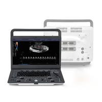 Échographe vétérinaire portable Sonoscape E1V réutilisable, convivial, sûr, fiable, durable, avec interface réglable pour chiens