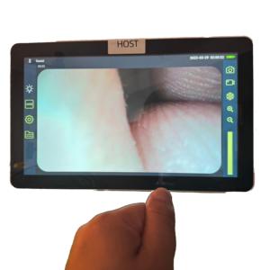 เครื่องประมวลผลระบบวิดีโอทางการแพทย์แบบฝังตัว4K 60fps กล้องเอนโดสโคปสองแชนเนลพร้อมเอาต์พุต <span class=keywords><strong>HD</strong></span>-MI 2.0 - Product Image 2