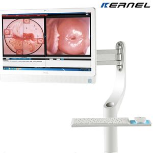 Medische Optische Colposcoop Apparaat Verticale Gynaecologische Colposcopie Medische Digitale Binoculaire Microscoop - Product Image 3