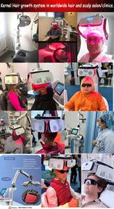 Tıbbi Trichology klinik kuaför kullanımı saç dökülmesi alopecia kellik tedavisi için 650nm lazer diyot LLLT saç büyüme makinesi - Product Image 3