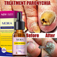 Sérum de Traitement Rapide des Mycoses des Ongles en 7 Jours OEM ODM, Huile Réparatrice pour Ongles Abîmés Marque Privée, Sérum Original pour la Croissance des Ongles