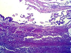 निर्माता मानव पैथोलॉजी अनुभाग स्लाइड 100 मानव स्थानीय सूजन माइक्रोस्कोप उपकरण के टुकड़ों का उत्पादन करते हैं - Product Image 3