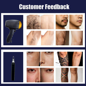 Épilateur 2-en-1 indolore : Solution de beauté pour la gestion des poils et l'atténuation des tatouages avec système de refroidissement CE - Product Image 4