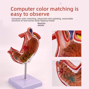 Modelo <span class=keywords><strong>de</strong></span> anatomía educativa <span class=keywords><strong>de</strong></span> Gastroenterología, sección coronal ampliada <span class=keywords><strong>de</strong></span> PVC, perforación patológica del estómago para la ciencia médica - Product Image 2