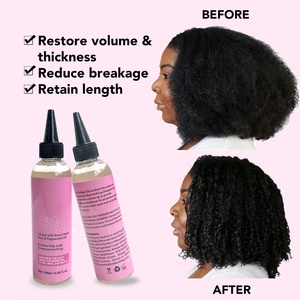 Cura del cuoio capelluto massaggiatore antiforfora per cuoio capelluto olio per capelli etichetta per bottiglia di olio per capelli stampata personalizzata olio per capelli biologico - Product Image 3