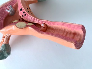 Modèle anatomique de l'utérus <span class=keywords><strong>humain</strong></span> en PVC de haute qualité, structure pathologique gynécologique, organes reproducteurs féminins pour l'enseignement CE/ISO - Product Image 5