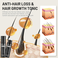 Peimei vente en gros 100% gingembre biologique Anti-perte de cheveux croissance des cheveux tonique huile sérum produit pour cheveux naturels avec castor DHT Blocker