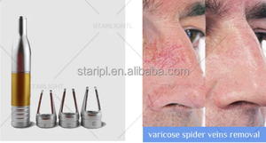 2025 frekuensi Radio tinggi 980nm <span class=keywords><strong>Laser</strong></span> mesin penghilang pembuluh darah bebas rasa sakit untuk vaskular Spider Vein perawatan kecantikan pribadi - Product Image 5