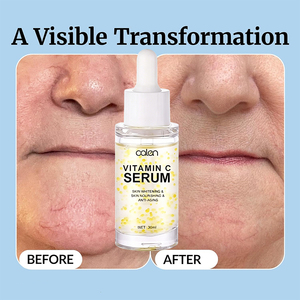 Sérum Visage Anti-rides et Éclaircissant Bio à l'Acide Hyaluronique et Vitamine C, 30ml, Marque Privée OEM - Product Image 4