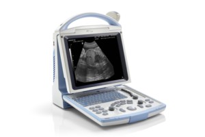 Venda quente <span class=keywords><strong>Mindray</strong></span> <span class=keywords><strong>DP</strong></span>-<span class=keywords><strong>10</strong></span> Full Digital Ultrasonic Diagnostic Imaging System Portátil Ultrasound Machine - Product Image 2
