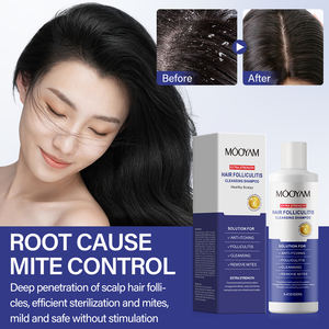 Shampooing anti-acné anti-démangeaisons à base de plantes 250ml extrait naturel de plante pour le <span class=keywords><strong>cuir</strong></span> <span class=keywords><strong>chevelu</strong></span> <span class=keywords><strong>psoriasis</strong></span> pellicules et contrôle de l'huile - Product Image 2