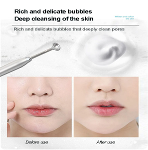 Nouvelle solution magique à bulles d'oxygène <span class=keywords><strong>actif</strong></span> pour le visage <span class=keywords><strong>SPA</strong></span> Nettoyage en profondeur des bulles pour purifier et revitaliser - Product Image 4