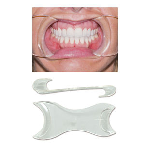 Strumenti dentali di apertura della bocca in plastica con riavvolgitori per foto e guance - Product Image 2